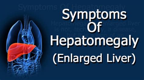 scratch test hepatomegaly|how to diagnose hepatomegaly.